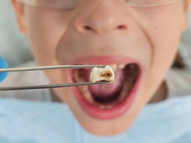  Vista Santa Rosa, CA Emergency Dentist Pros